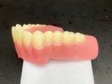 Something to Smile About: 3D Systems Announces Commercial Release of 3D Printed Denture Solution – 3DPrint.com