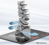 Carlsmed to Go Public in $101 Million Bid to Scale 3D Printed Spine Implants – 3DPrint.com
